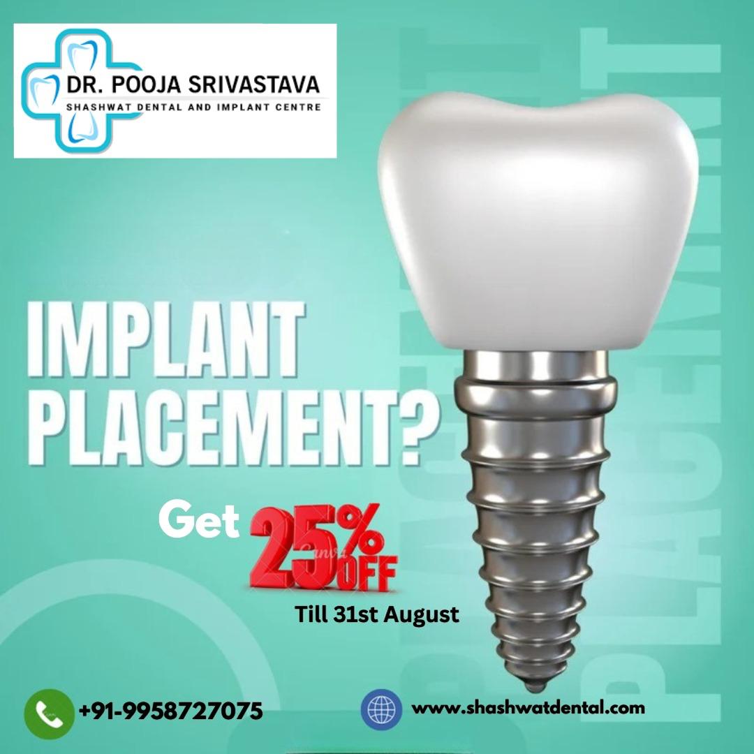 Why Dental Teeth Cleaning Every 6 Months is Necessary